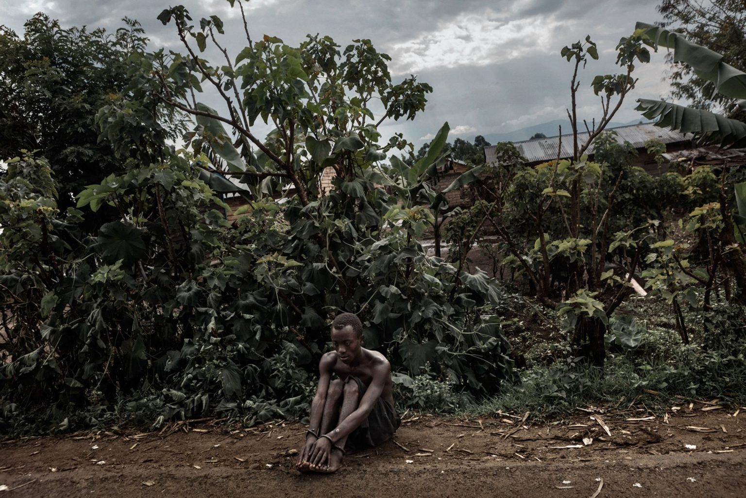 A view of the territory of the Province of Rutshuru, governed by the M23 rebels, successors of the CNDP and accused by both the UN and the government of Kinshasa of being supported by Rwanda. A mentally ill kid chained is sitting on the edge of the road. He has been shackled by his parents because he used to throw rocks against M23's vehicles. Goma, North Kivu, Democratic Republic of Congo, 2012