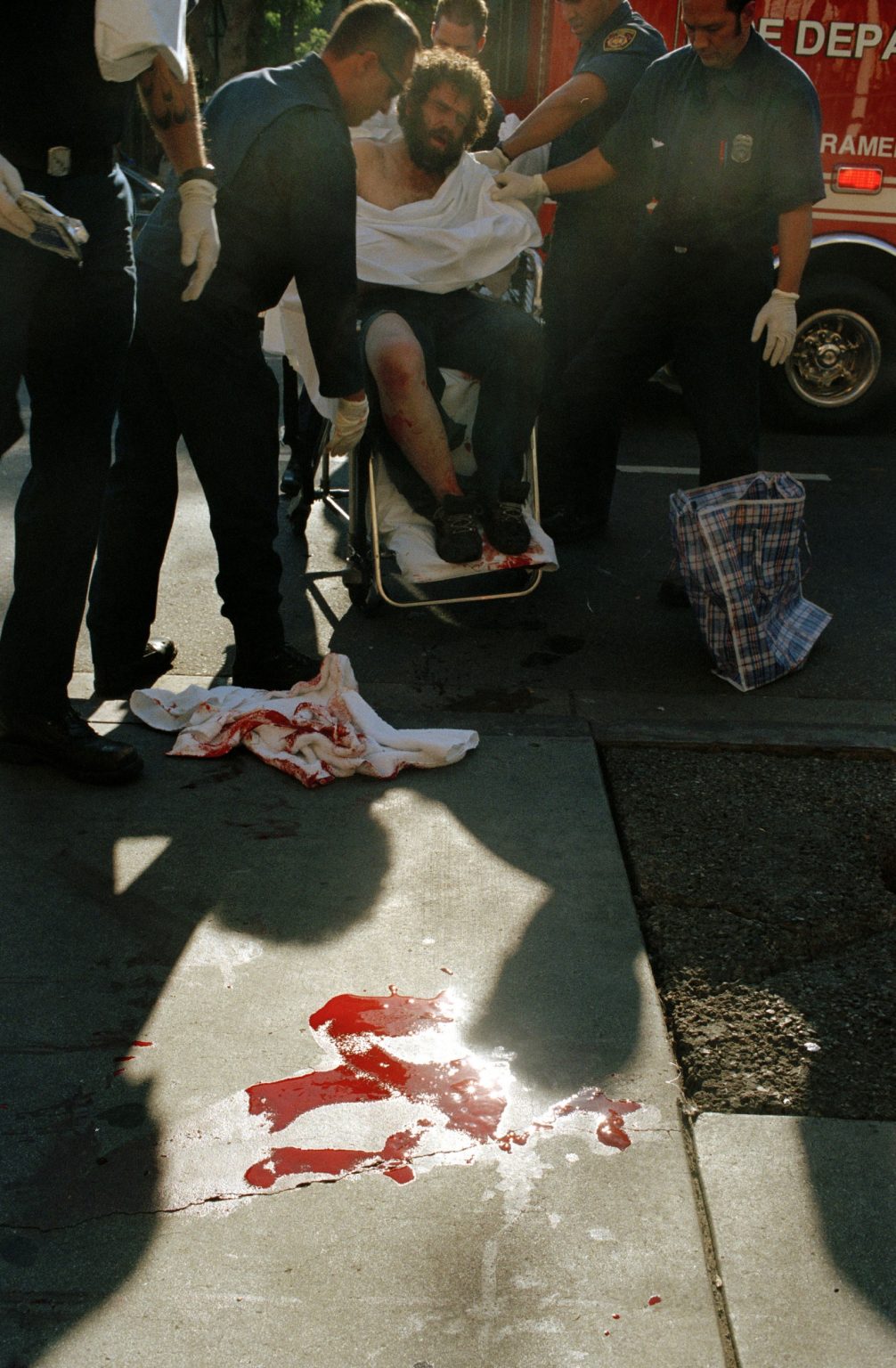 Los Angeles 2004 - Skid Row  - Man stabbed on the street, 5th street
><
Los Angeles 2004 - Skid Row - 5th street - Uomo accoltellato in strada *** Local Caption *** 00216519